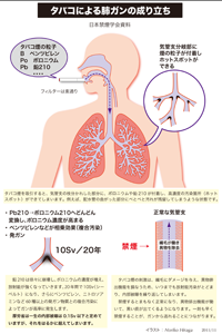 タバコによる肺ガンの成り立ち